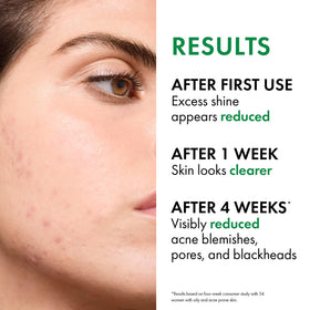 VICHY Normaderm pump dispense detail for controlled, mess-free application