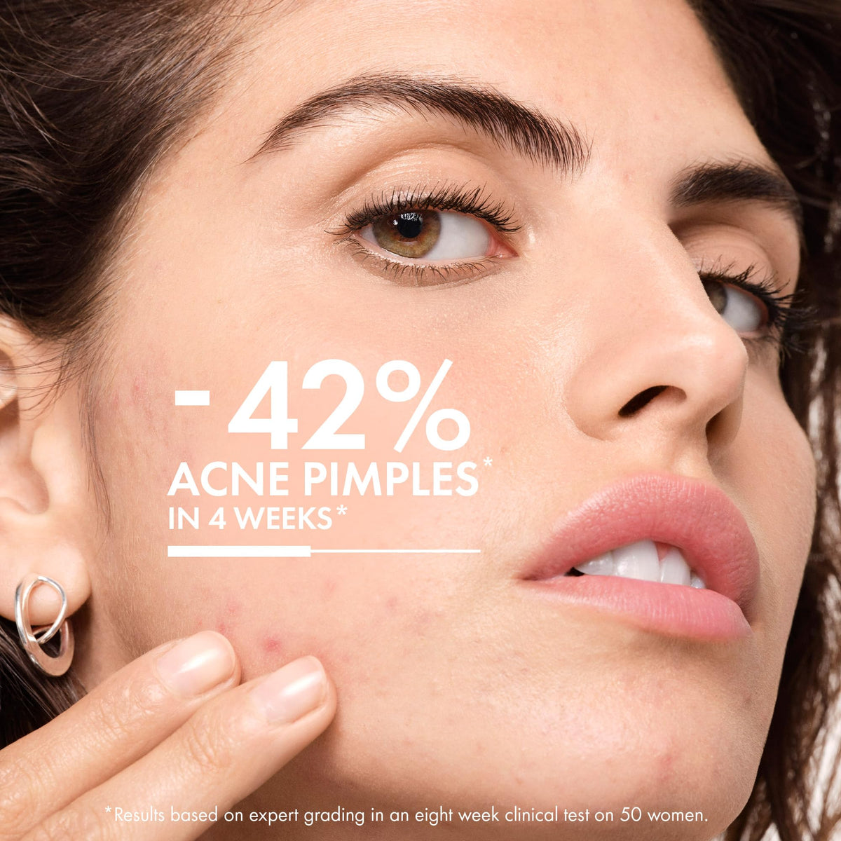 VICHY Normaderm cream texture close-up highlighting lightweight, oil-free hydration