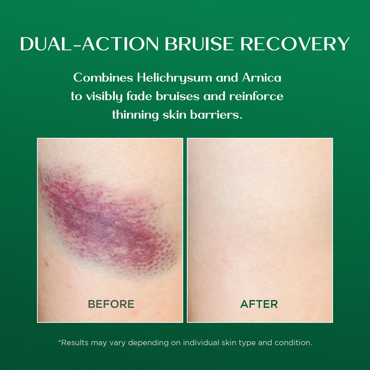 Vigority cream being applied on forearm to soothe and restore skin