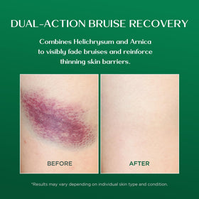 Vigority cream being applied on forearm to soothe and restore skin