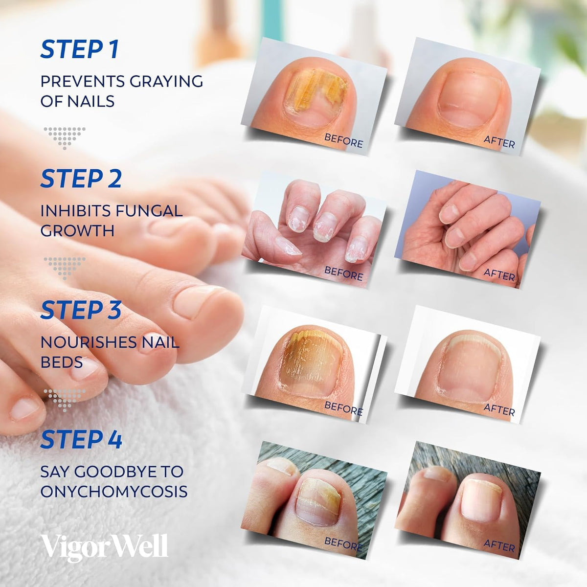 VigorWell clear liquid drop on nail demonstrating targeted delivery