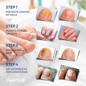 VigorWell clear liquid drop on nail demonstrating targeted delivery