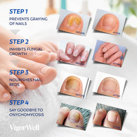 VigorWell patch applied on toenail during nighttime for discreet repair
