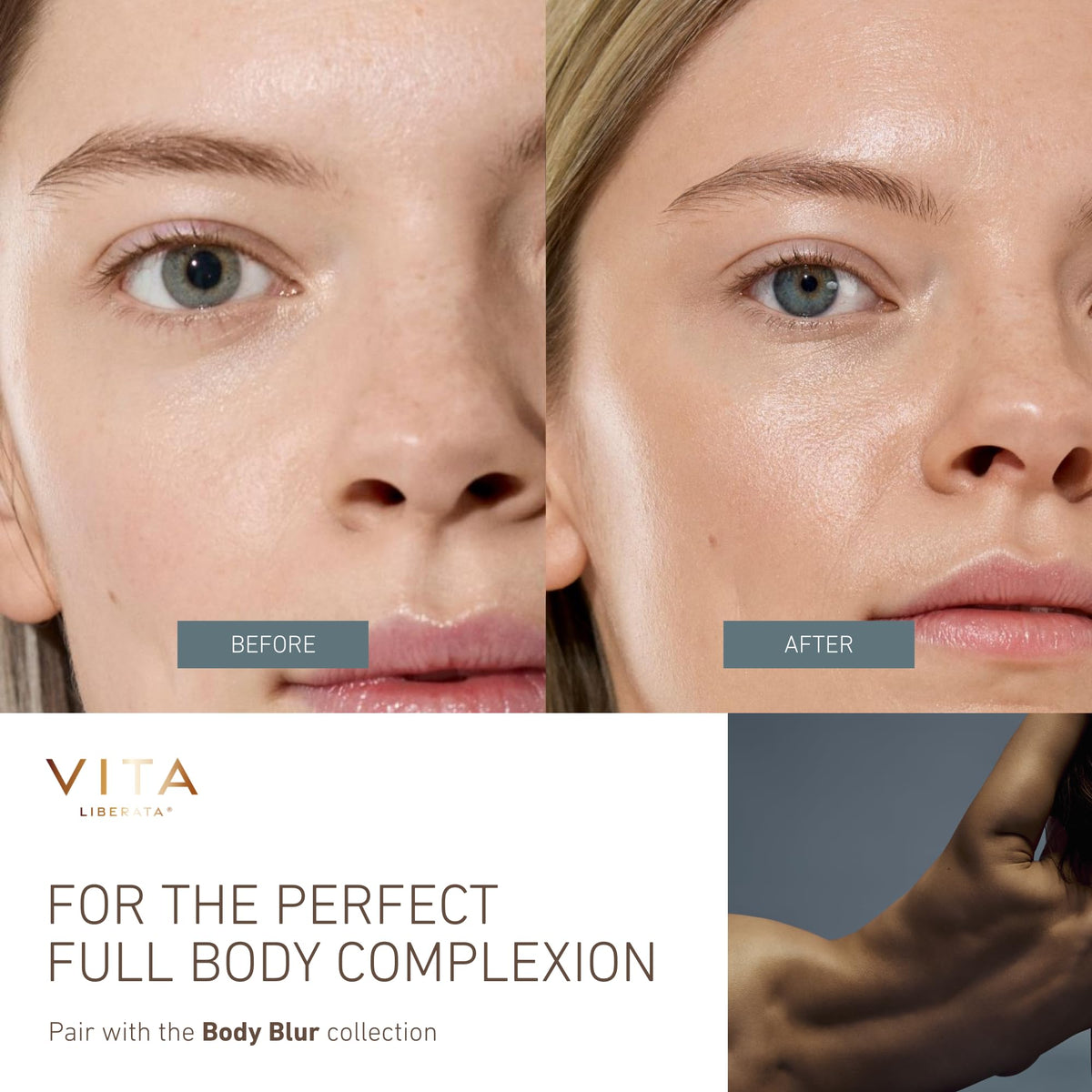 VITA LIBERATA lifestyle image wearing summer outfit showing radiant skin result