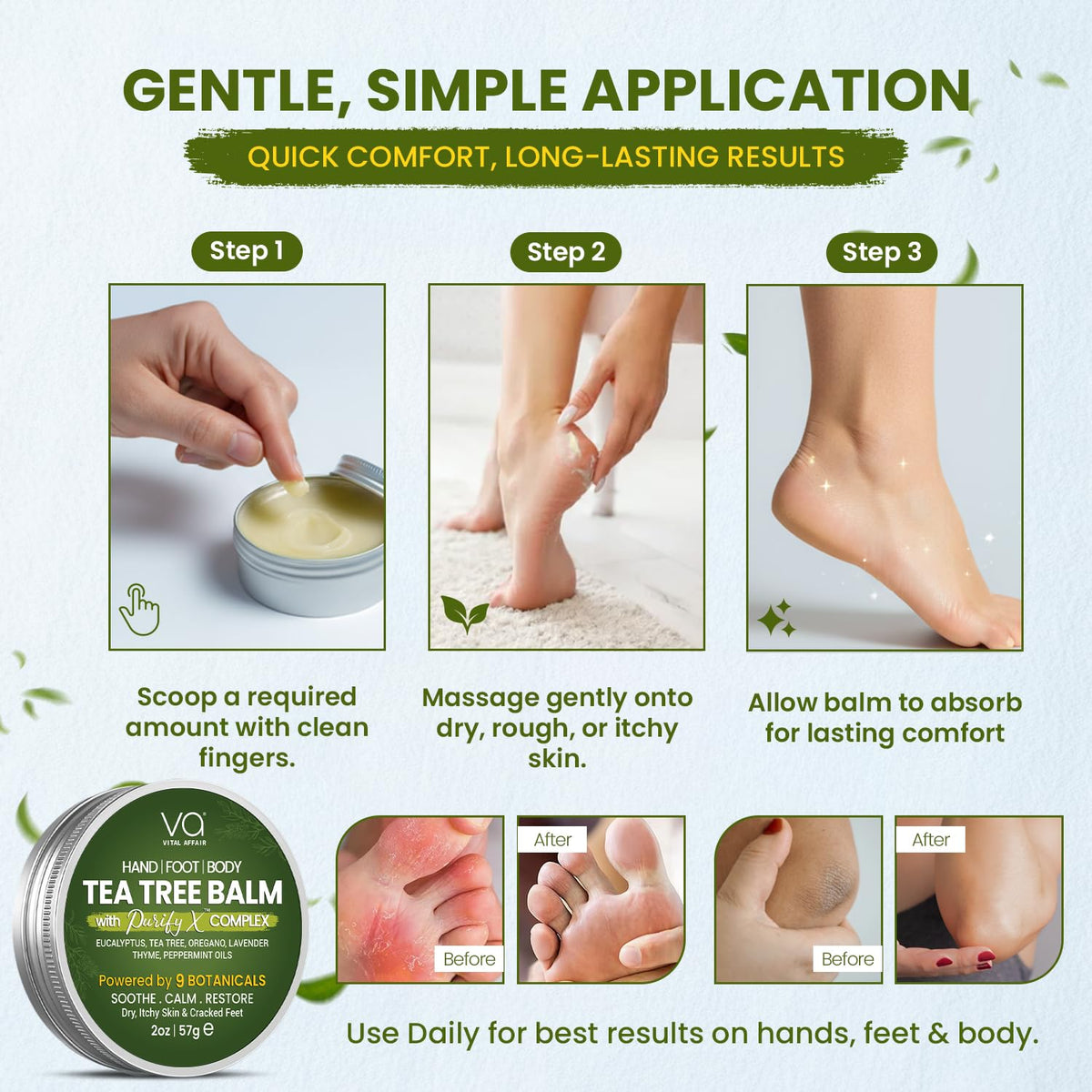 VITAL AFFAIR bedside lifestyle shot showing nighttime foot care routine and comfort