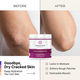 Vitality hand applying balm to knuckles demonstrating quick absorption benefit