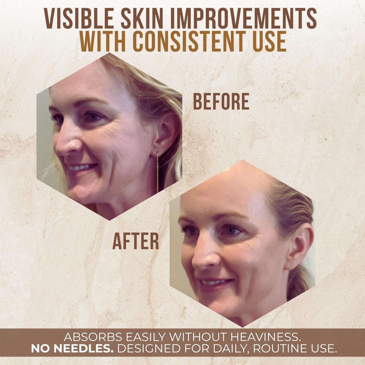 Vitamo cream being applied to neck for firming and hydration