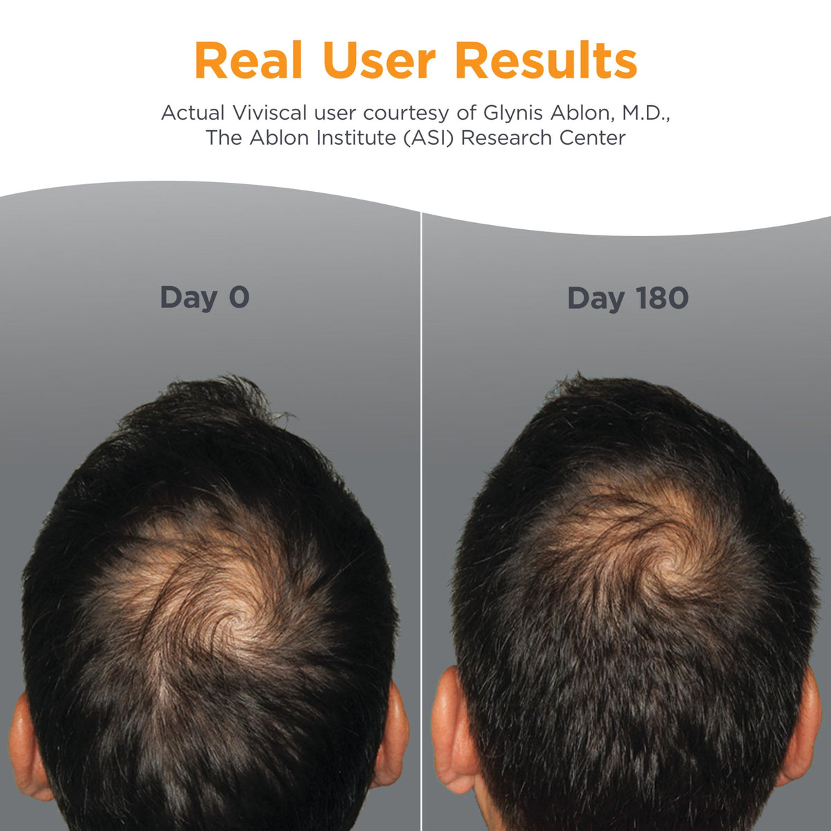 Viviscal Man tablets close-up highlighting texture and easy daily dose