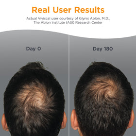 Viviscal Man tablets close-up highlighting texture and easy daily dose