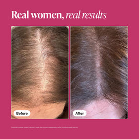 Viviscal bottle beside hairbrush illustrating support for reduced shedding
