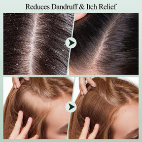 VOERUY being applied to wet hair in shower for thorough scalp refresh