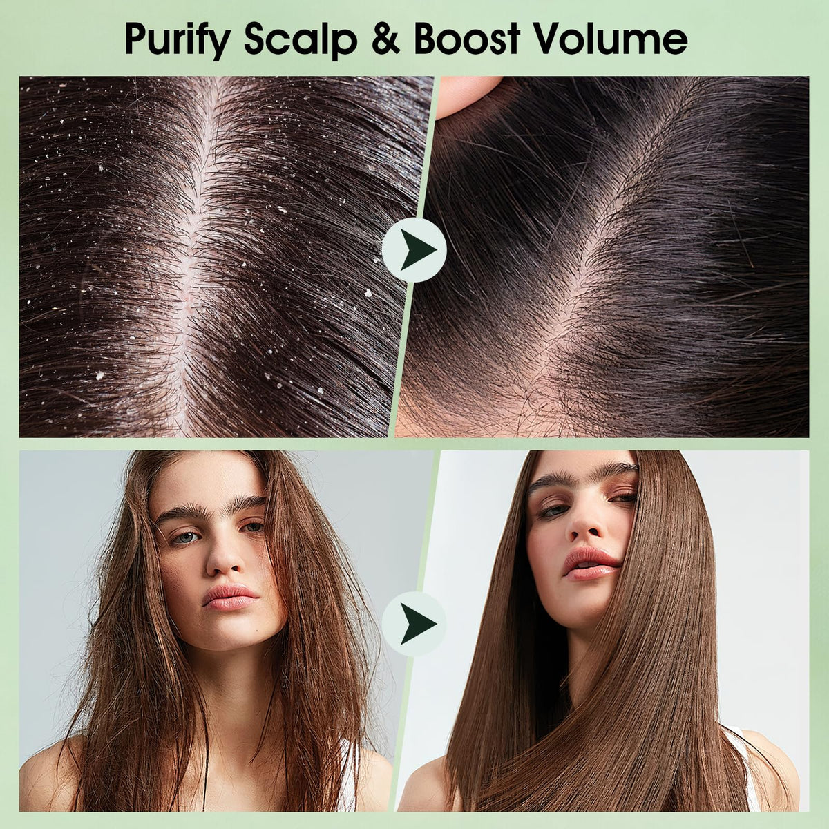 VOERUY in-hand application demonstrating easy scoop and targeted scalp treatment for comfort