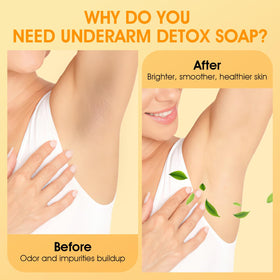 VOERUY soap bag and both bars displayed, convenient kit for easy foaming