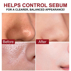 VOFANK before and after skin texture, illustrates clearer smoother complexion