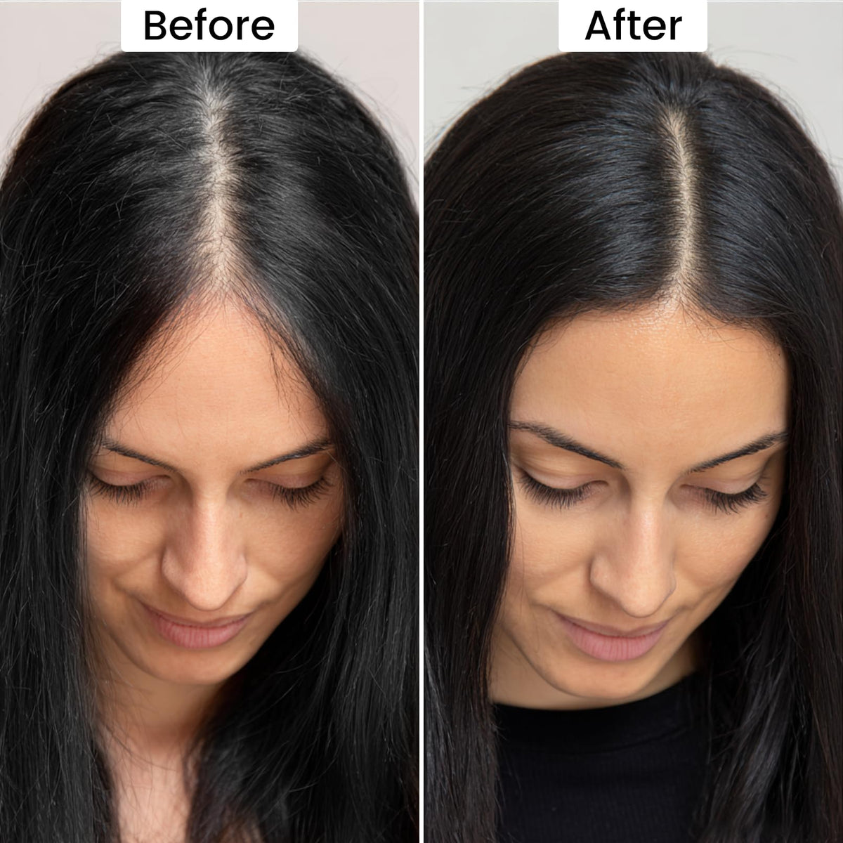 VOLLUCK sponge applicator detail for precise root coverage and control