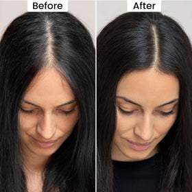VOLLUCK sponge applicator detail for precise root coverage and control