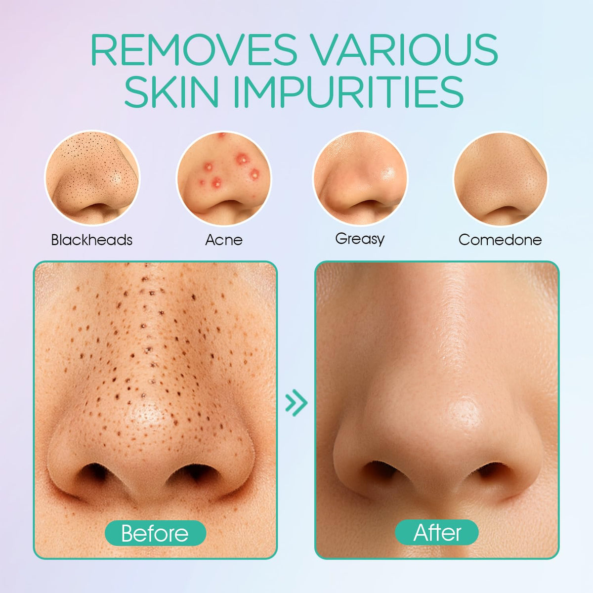 VOYOR BR410 silicone soft tip close-up highlighting gentle action for sensitive skin