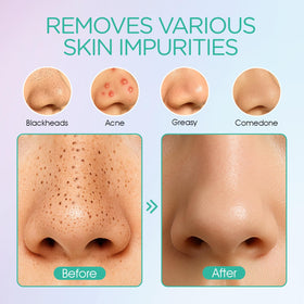 VOYOR BR410 silicone soft tip close-up highlighting gentle action for sensitive skin