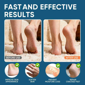 VREKEF being applied to a heel to soften rough skin and hydrate