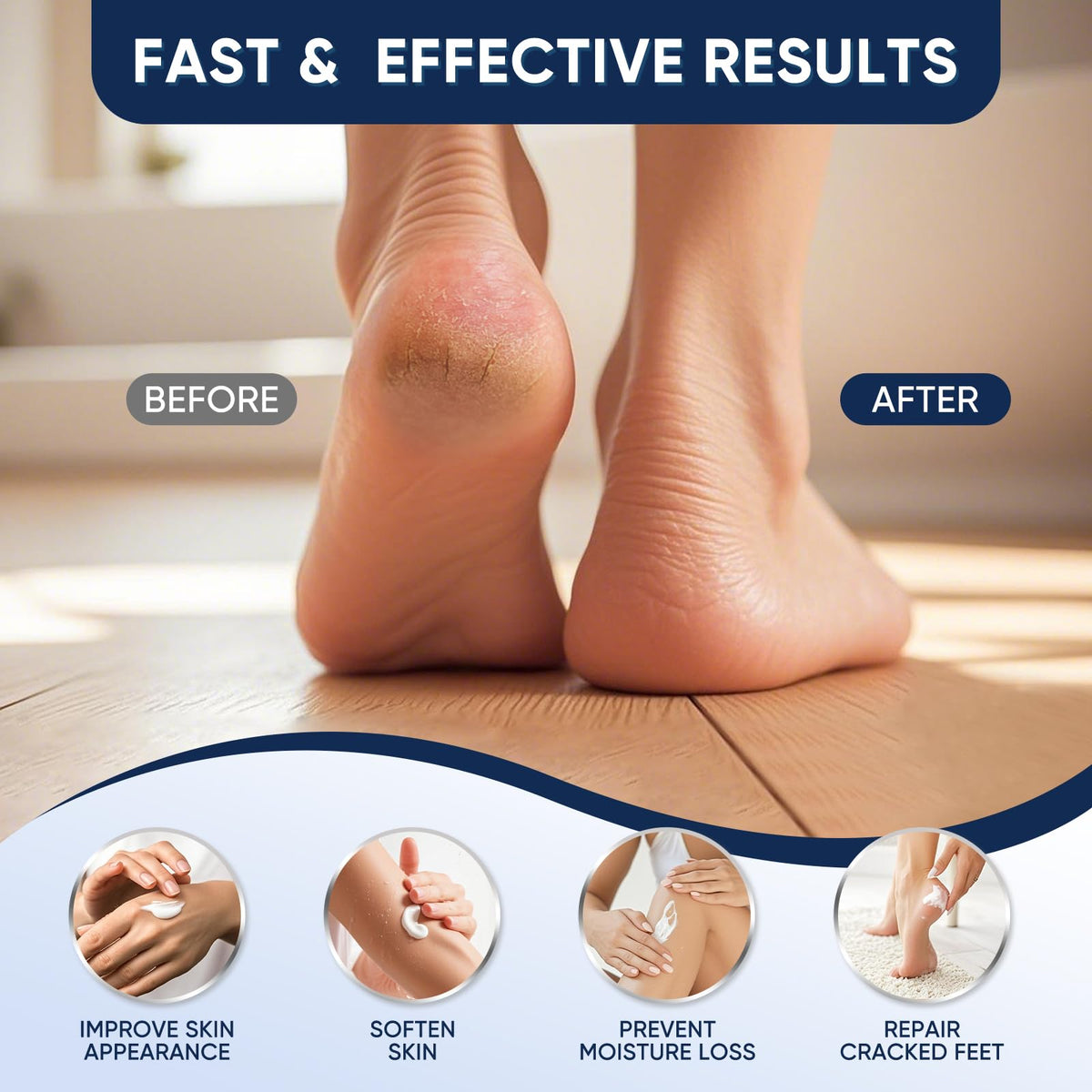 VREKEF before and after callus comparison showing smoother heels