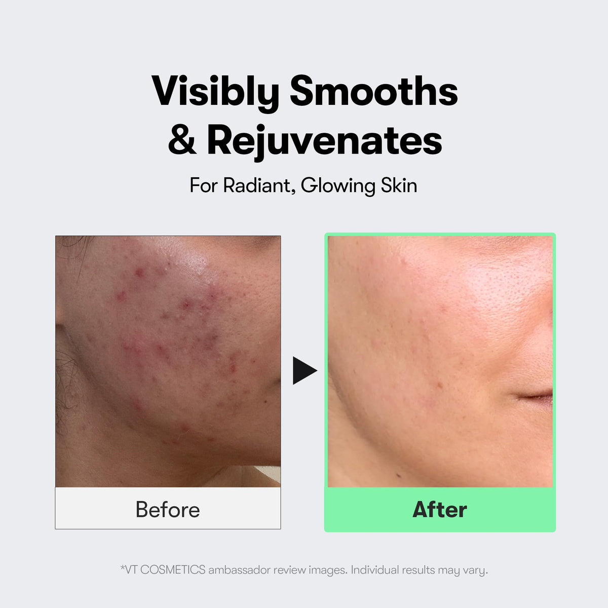 VT COSMETICS Reedle Shot used in a nighttime routine for improved absorption benefit