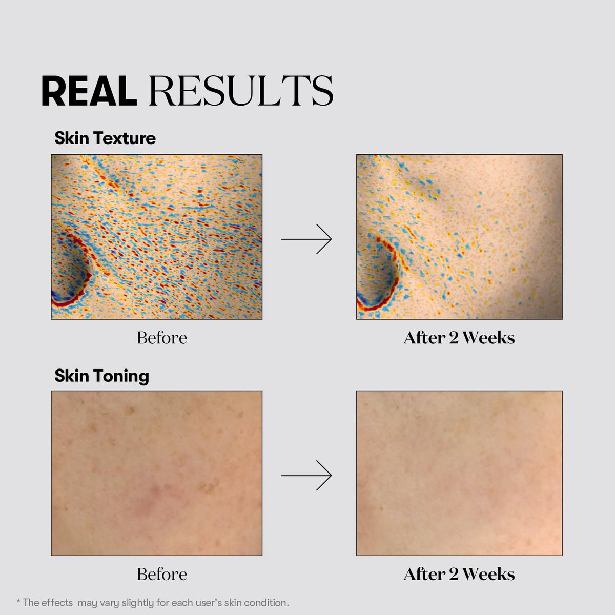 VT COSMETICS mask applied on model showing comfortable fit benefit
