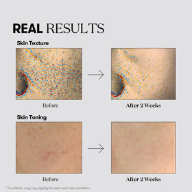 VT COSMETICS mask applied on model showing comfortable fit benefit
