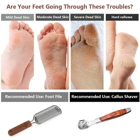 Vusoset in-use image of foot scrubbing demonstrating smoother heels benefit