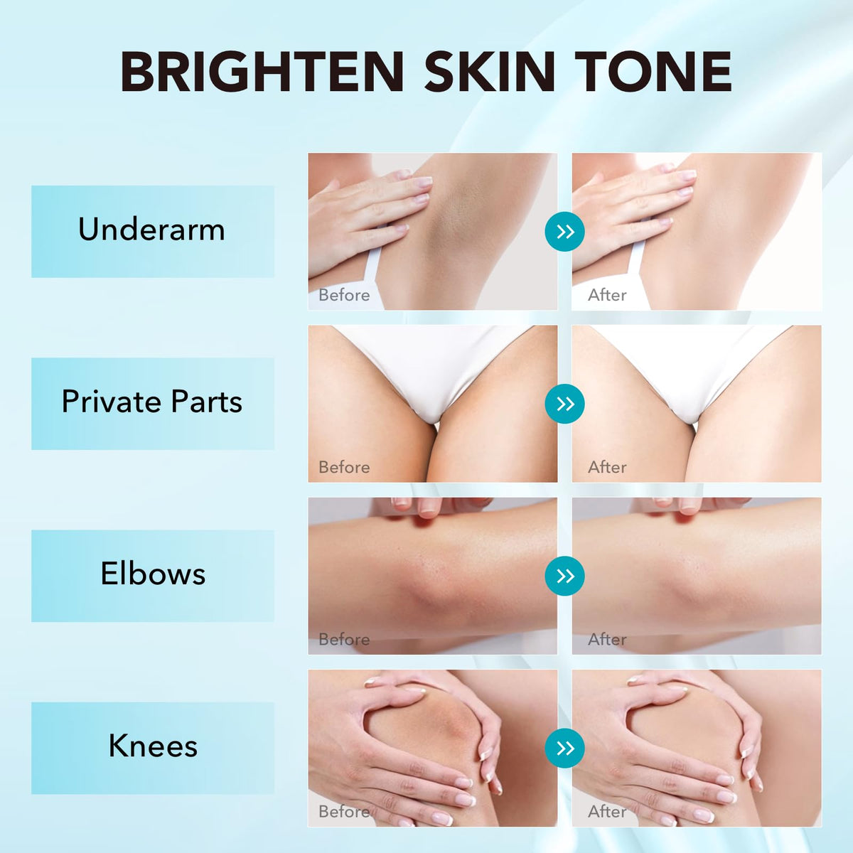 VZP applied to underarm demonstrating targeted dark spot care