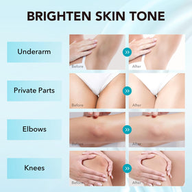 VZP applied to underarm demonstrating targeted dark spot care