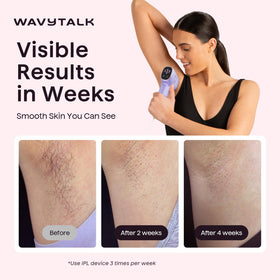 wavytalk precision roller close-up highlighting even flash delivery for accuracy