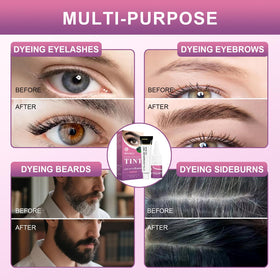 WEILNELL open kit with tools and tubes, highlighting complete set
