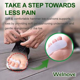 Welnove in-use on foot demonstrating toe separation and improved shoe comfort