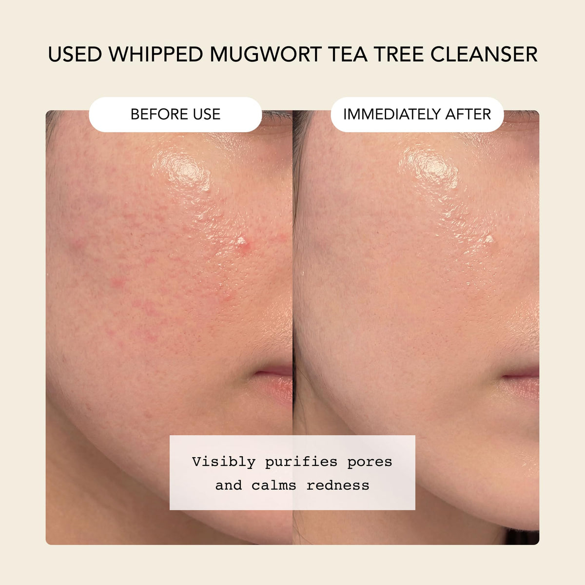 Whipped Semo Company mask application on face for quick pore care