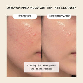 Whipped Semo Company mask application on face for quick pore care