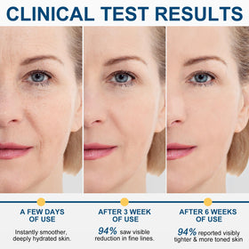 WHLH & WELL-BEING illustrative before and after texture comparison showing improved smoothness benefit
