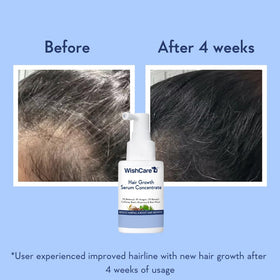 Side-by-side comparison scale showing improved density appearance using WishCare