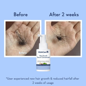 Person applying WishCare serum to scalp, promoting easy nightly application