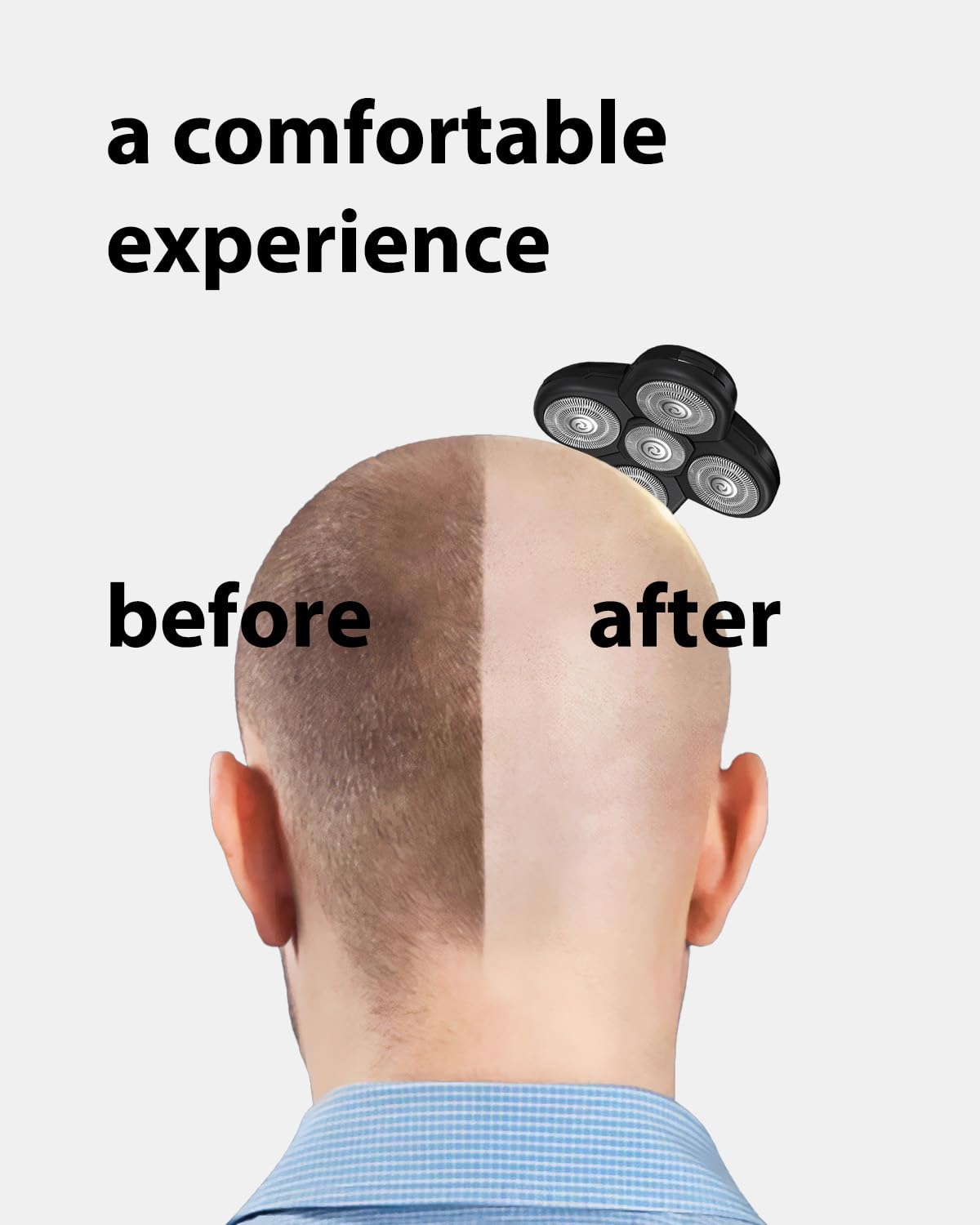 wotdmu replacement head in use on a bald scalp for smooth results