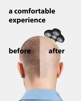 wotdmu replacement head in use on a bald scalp for smooth results