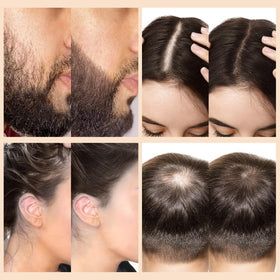 WOZUTUNT after-application profile view showing natural-looking thicker hair result