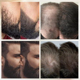 WOZUTUNT lifestyle image of man with enhanced beard boosting confidence