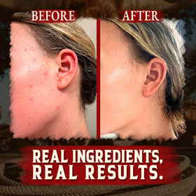 Wrath & Remedy ingredients display with tallow, olive, jojoba, honey benefits