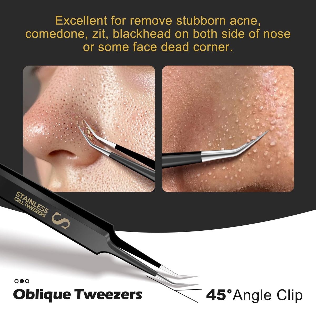 WSYUB curved tweezer pictured on nose wing targeting stubborn blackheads