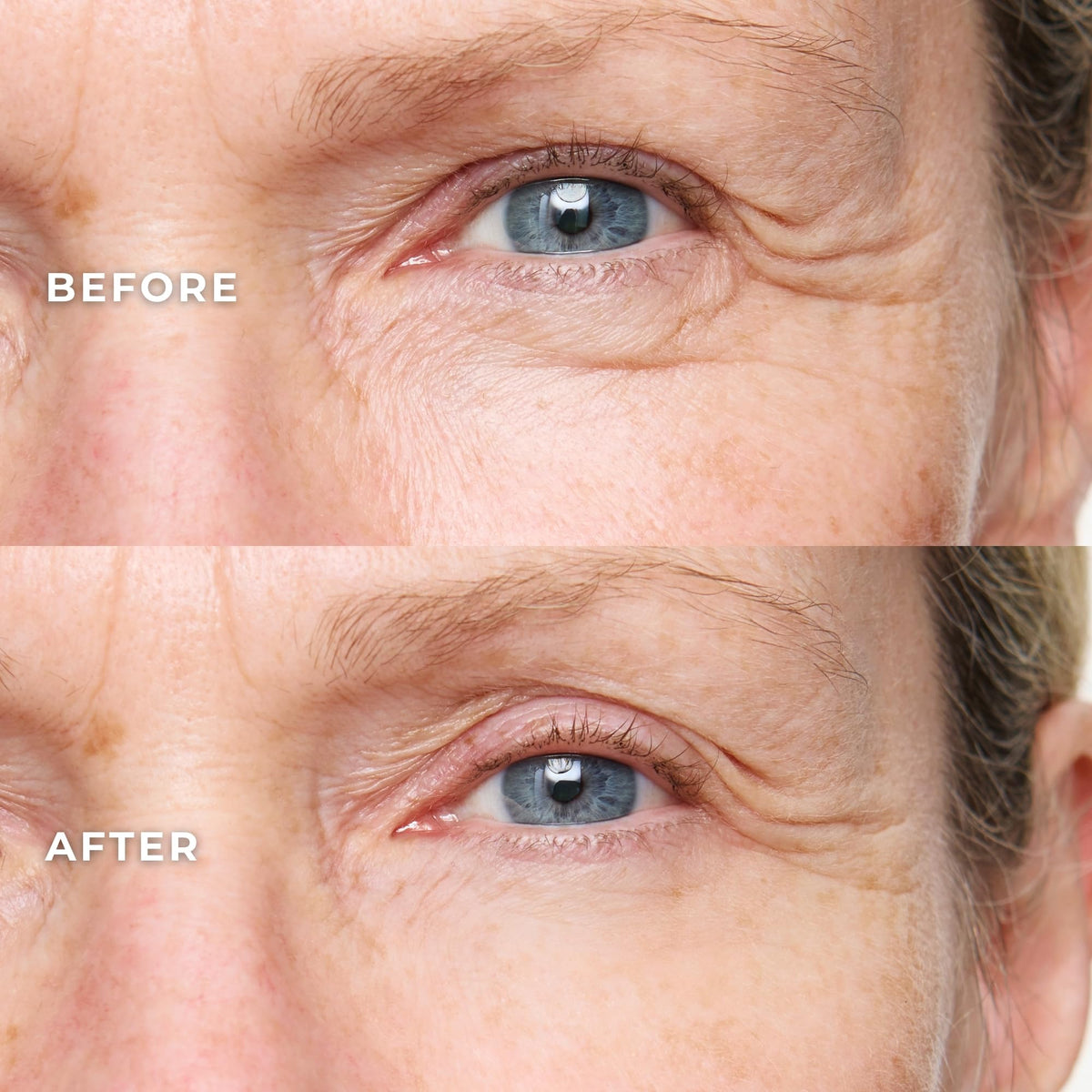 WUNDER2 pipette detail dispensing serum illustrating precise application benefit