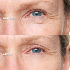 WUNDER2 pipette detail dispensing serum illustrating precise application benefit