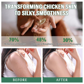 Xaarty cream being applied to hand demonstrating soothing targeted comfort