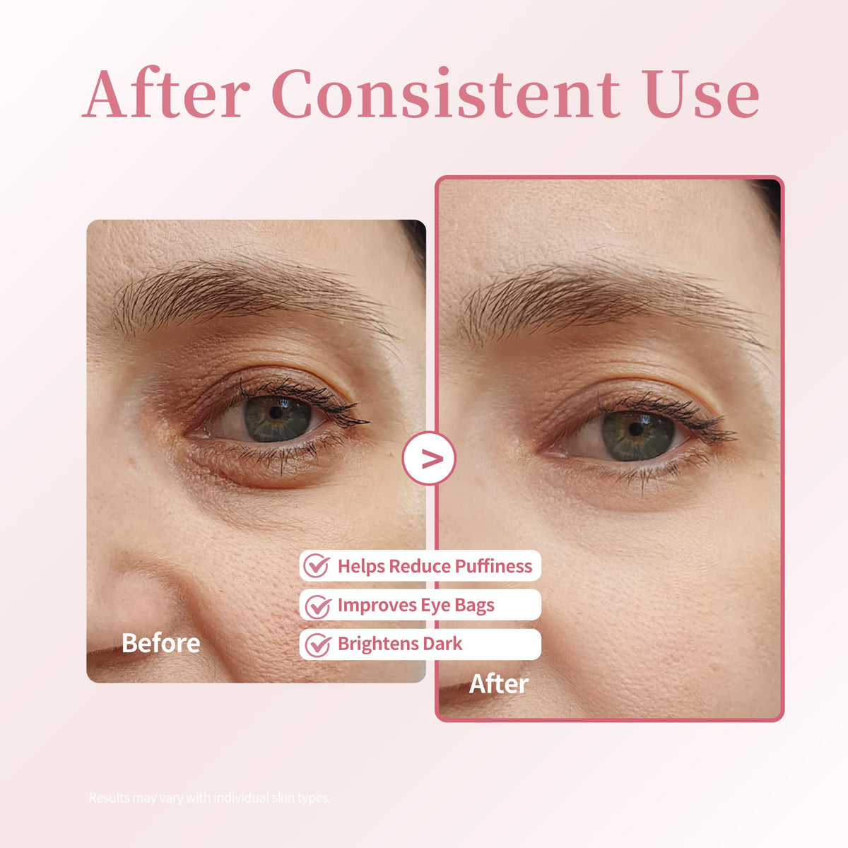 Xenjura applying roller under-eye to reduce puffiness and refresh appearance