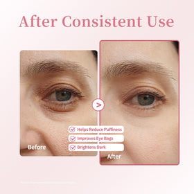Xenjura applying roller under-eye to reduce puffiness and refresh appearance