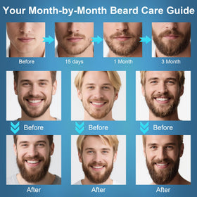 XIKEZAN beard oils bottles displayed, provide daily moisture benefit